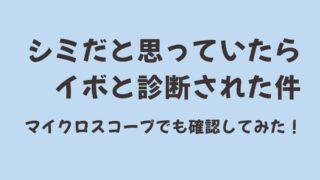シミだと思っていたらイボだと言われた件